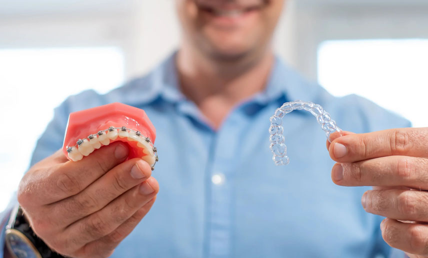 Thinking About Braces or Clear Aligners at 40? Thinking About Braces or Clear Aligners at 40?